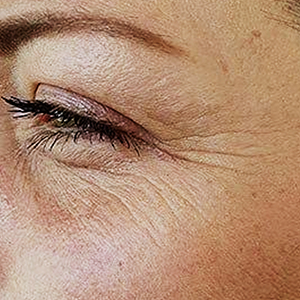fine lines & wrinkless