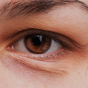hooded eyes