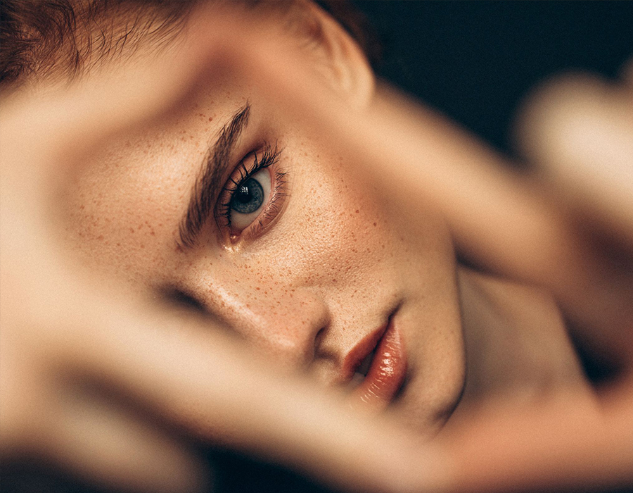 Blepharoplasty in Dubai discover the art of natural eyelid rejuvenation with Dr. Dragana Spica