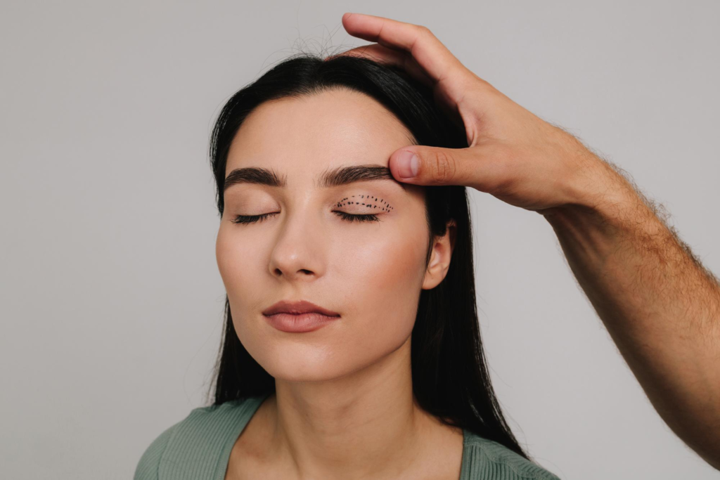Blepharoplasty Recovery Timeline And Aftercare Tips