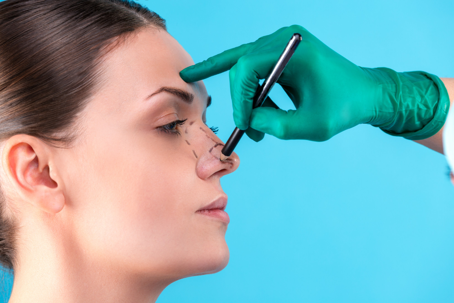 Enhance Your Look: A Complete Guide To Non-surgical Nose Fillers