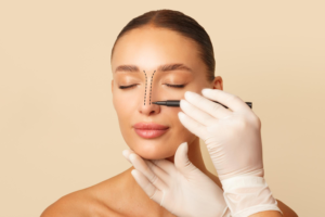 Nose Filler Aftercare What To Do And Avoid After Non-Surgical Rhinoplasty